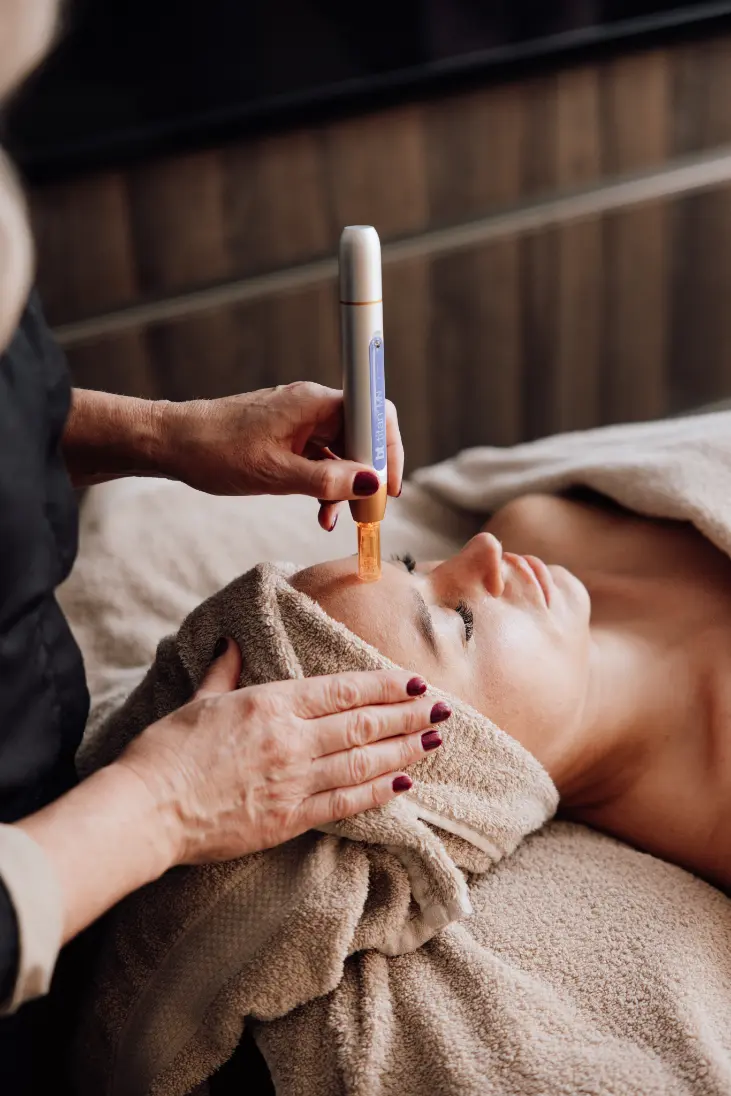 Microneedling in Eindhoven